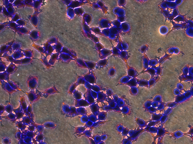 Multiwell Platte Greiner