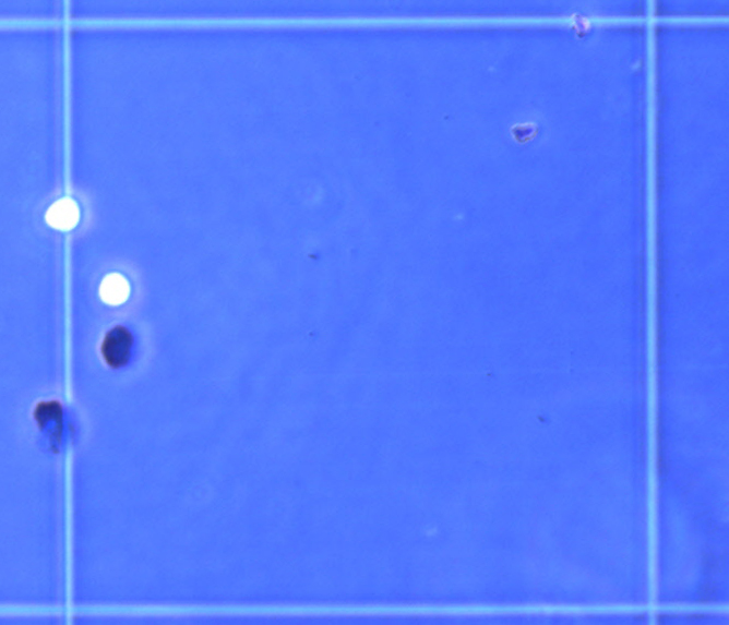 Zellzählung Counter Trypanblaufärbung in Neubauerkammer